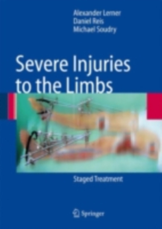 Severe Injuries to the Limbs (e-bog) af Soudry, Michael