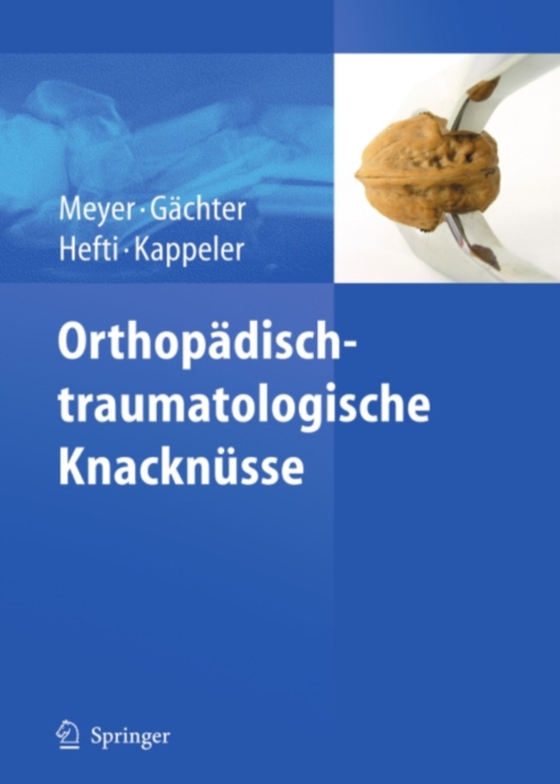 Orthopädisch-traumatologische Knacknüsse (e-bog) af -