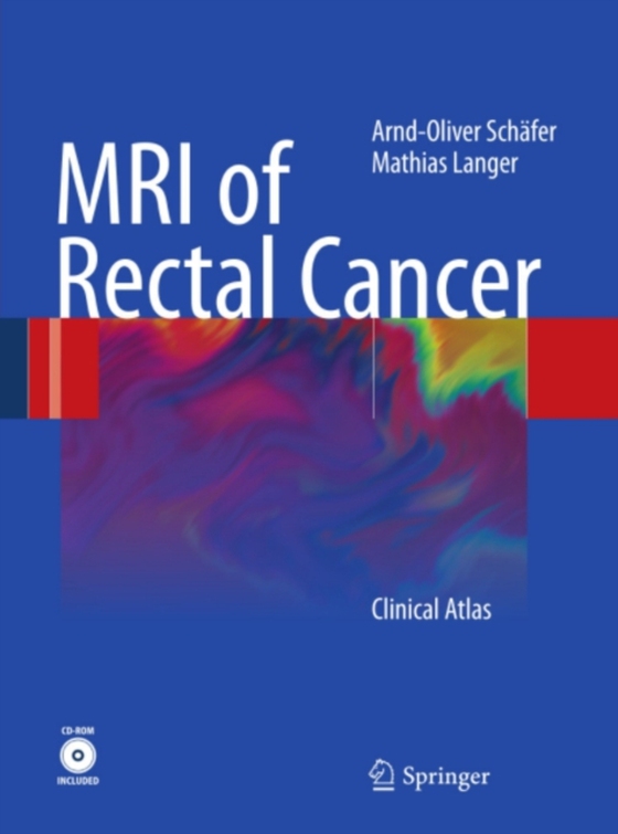 MRI of Rectal Cancer (e-bog) af Langer, Mathias