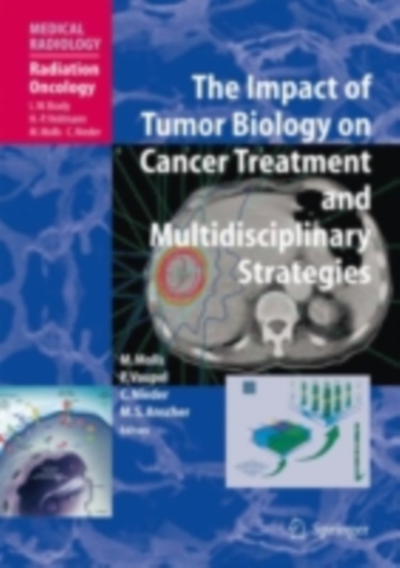 Impact of Tumor Biology on Cancer Treatment and Multidisciplinary Strategies (e-bog) af -