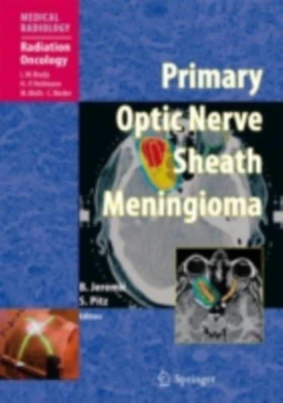 Primary Optic Nerve Sheath Meningioma (e-bog) af -