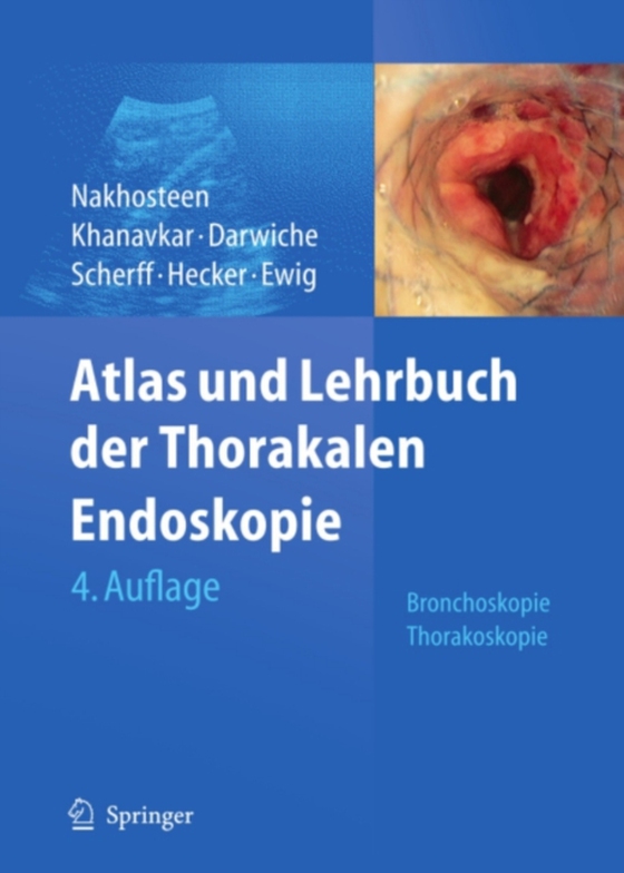 Atlas und Lehrbuch der Thorakalen Endoskopie (e-bog) af -