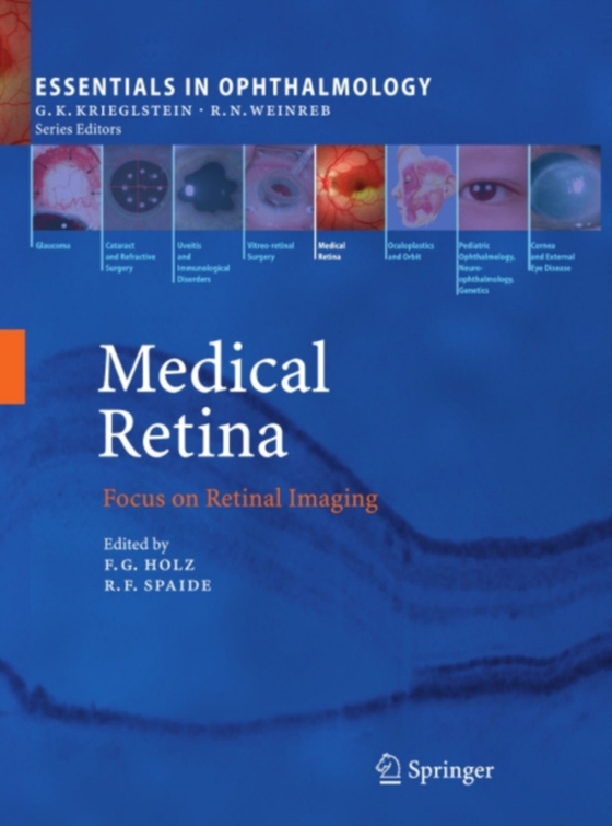 Medical Retina (e-bog) af -