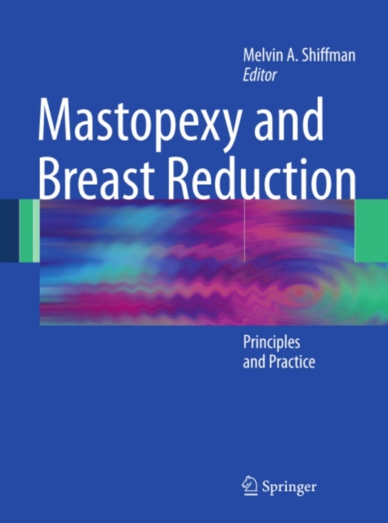 Mastopexy and Breast Reduction (e-bog) af -