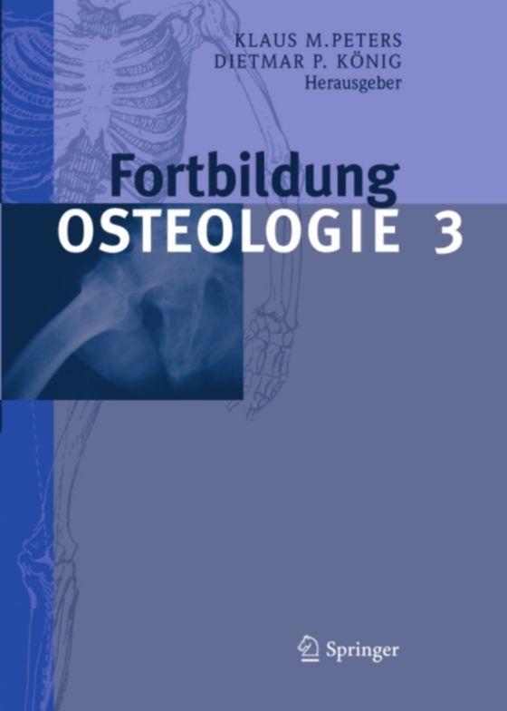 Fortbildung Osteologie 3 (e-bog) af -