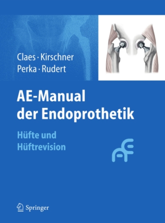 AE-Manual der Endoprothetik (e-bog) af -