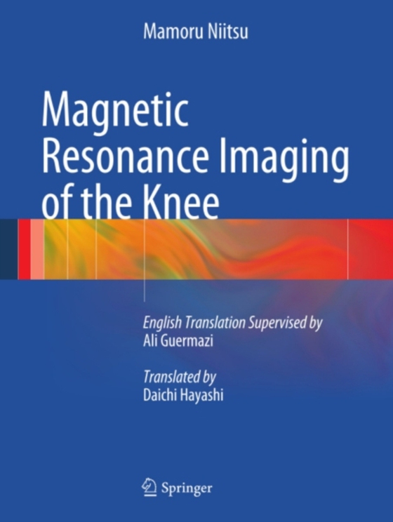 Magnetic Resonance Imaging of the Knee (e-bog) af Niitsu, Mamoru