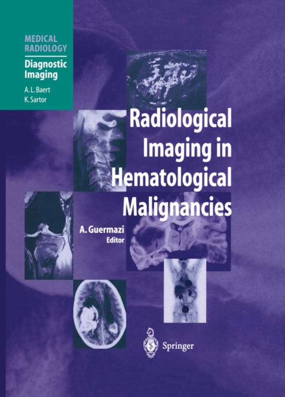 Radiological Imaging in Hematological Malignancies (e-bog) af -