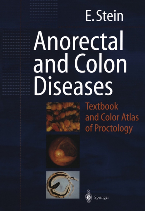 Anorectal and Colon Diseases (e-bog) af Stein, E.