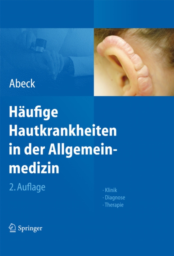 Häufige Hautkrankheiten in der Allgemeinmedizin (e-bog) af Abeck, Dietrich