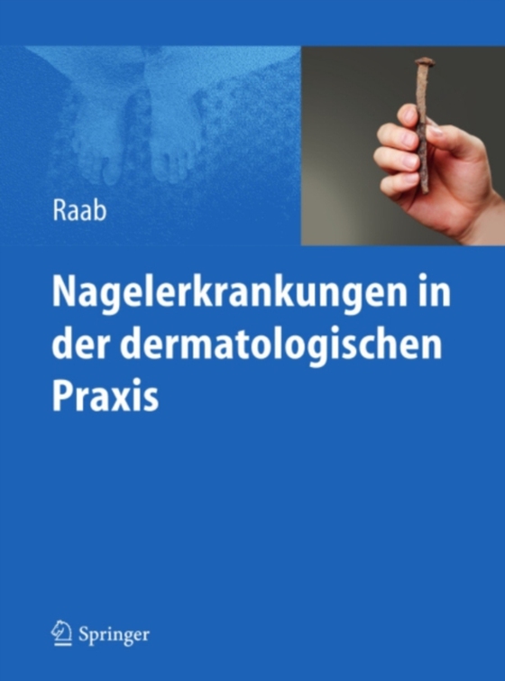 Nagelerkrankungen in der dermatologischen Praxis