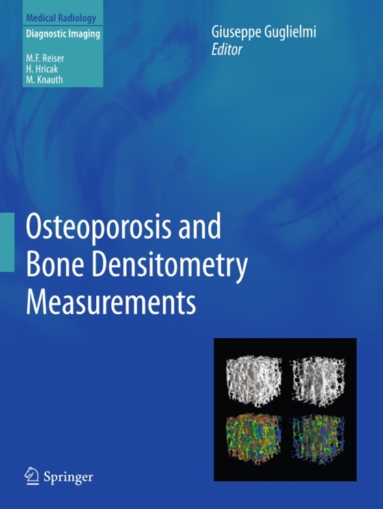 Osteoporosis and Bone Densitometry Measurements (e-bog) af -