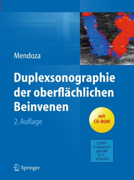 Duplexsonographie der oberflächlichen Beinvenen (e-bog) af Mendoza, Erika