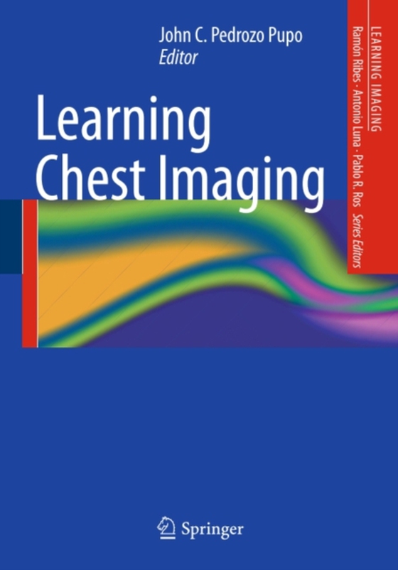 Learning Chest Imaging (e-bog) af -