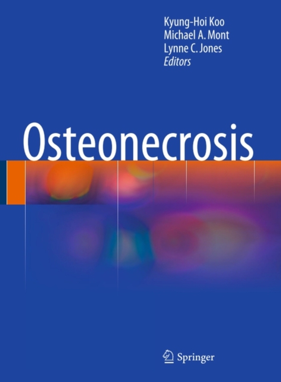 Osteonecrosis (e-bog) af -