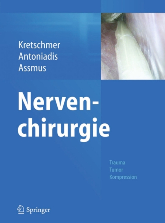 Nervenchirurgie (e-bog) af -