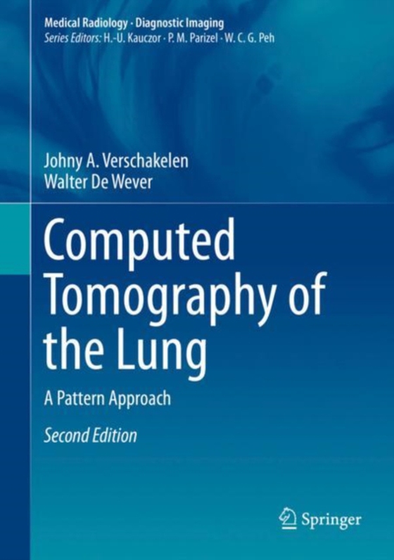 Computed Tomography of the Lung (e-bog) af Wever, Walter De