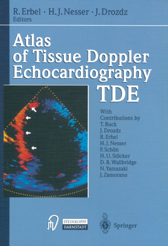 Atlas of Tissue Doppler Echocardiography - TDE (e-bog) af -