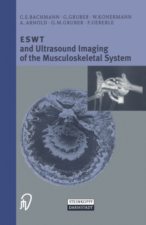 ESWT and Ultrasound Imaging of the Musculoskeletal System (e-bog) af Ueberle, F.