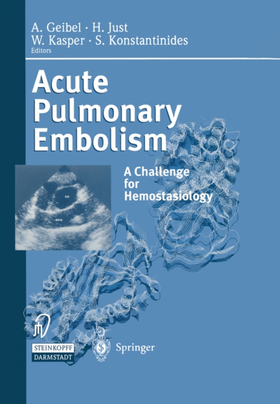 Acute Pulmonary Embolism (e-bog) af -