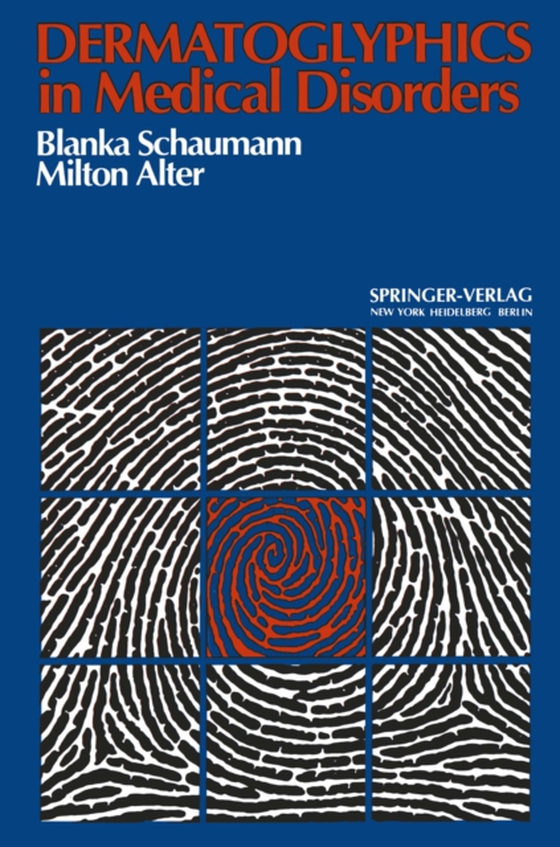 Dermatoglyphics in Medical Disorders (e-bog) af Alter, M.