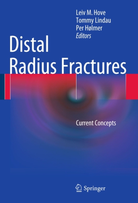 Distal Radius Fractures (e-bog) af -