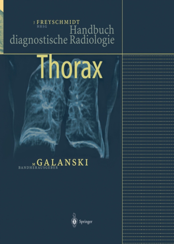 Thorax (e-bog) af -