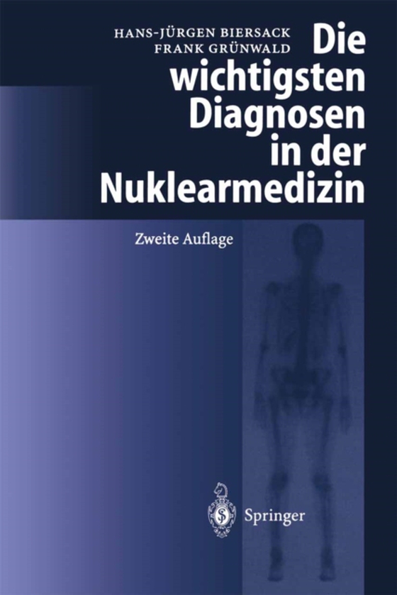 Die wichtigsten Diagnosen in der Nuklearmedizin (e-bog) af -