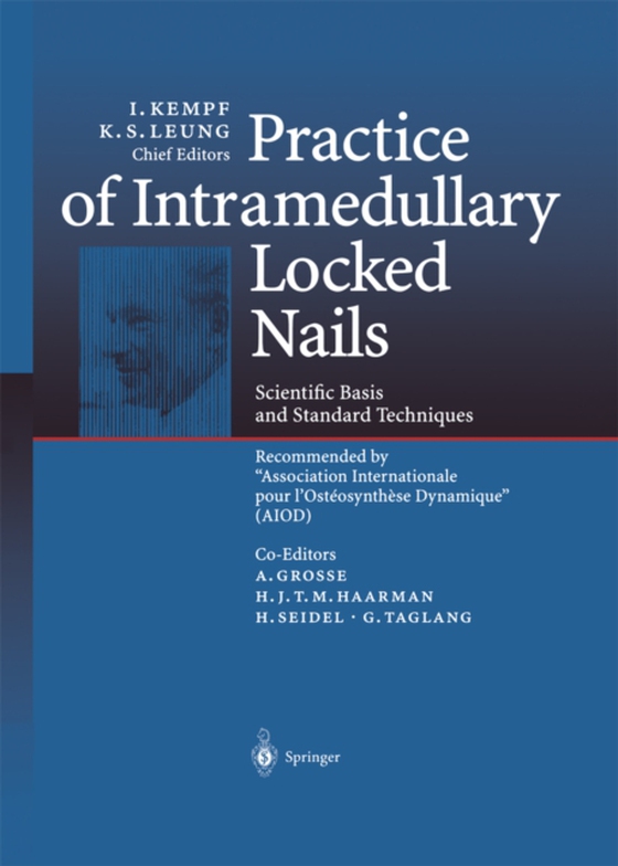 Practice of Intramedullary Locked Nails (e-bog) af -