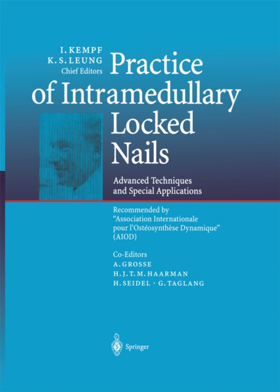 Practice of Intramedullary Locked Nails (e-bog) af -