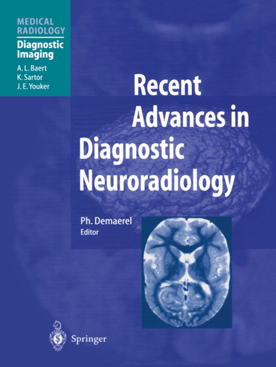 Recent Advances in Diagnostic Neuroradiology (e-bog) af -