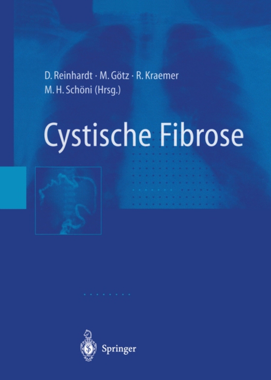 Cystische Fibrose (e-bog) af -