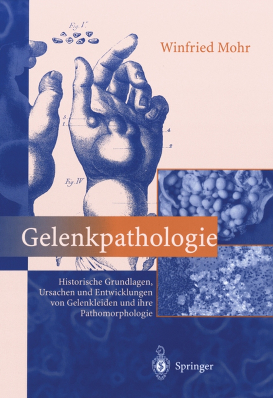 Gelenkpathologie (e-bog) af Mohr, Winfried