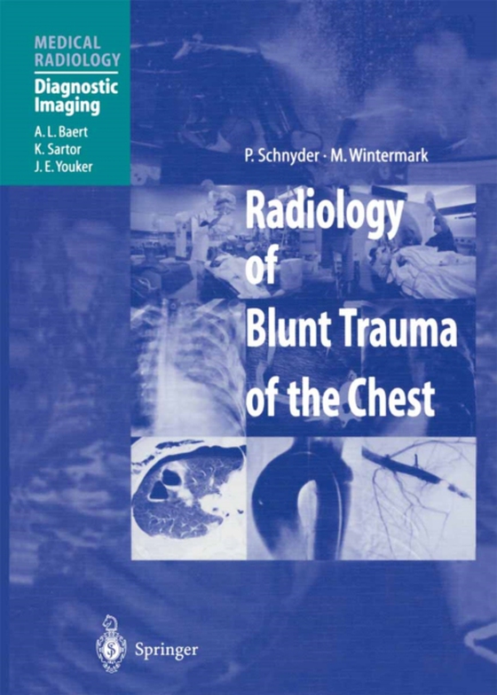 Radiology of Blunt Trauma of the Chest (e-bog) af Wintermark, M.