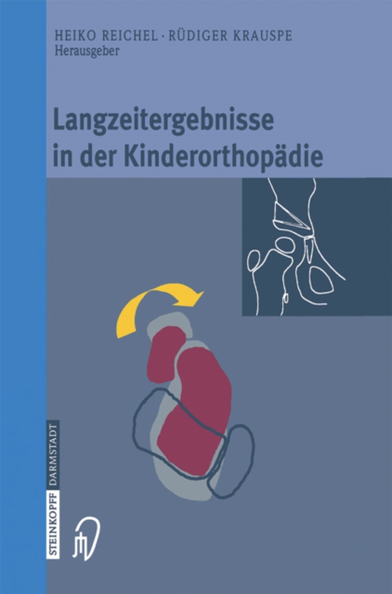 Langzeitergebnisse in der Kinderorthopädie (e-bog) af -