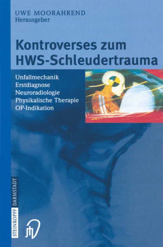 Kontroverses zum HWS-Schleudertrauma (e-bog) af -