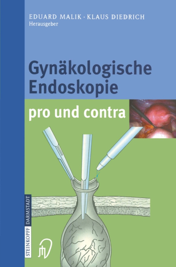 Gynäkologische Endoskopie pro und contra (e-bog) af -