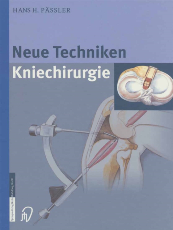 Neue Techniken Kniechirurgie (e-bog) af Passler, H.H.