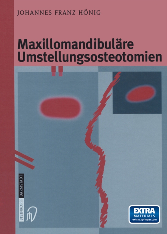 Maxillomandibuläre Umstellungsosteotomien (e-bog) af Honig, Johannes-Franz