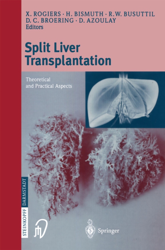 Split liver transplantation (e-bog) af -