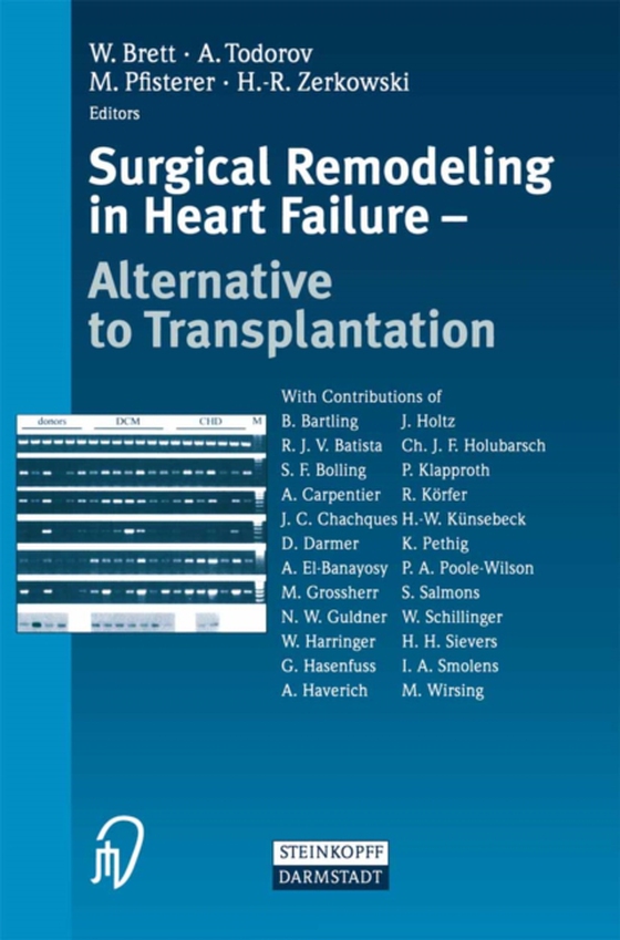 Surgical Remodeling in Heart Failure (e-bog) af -