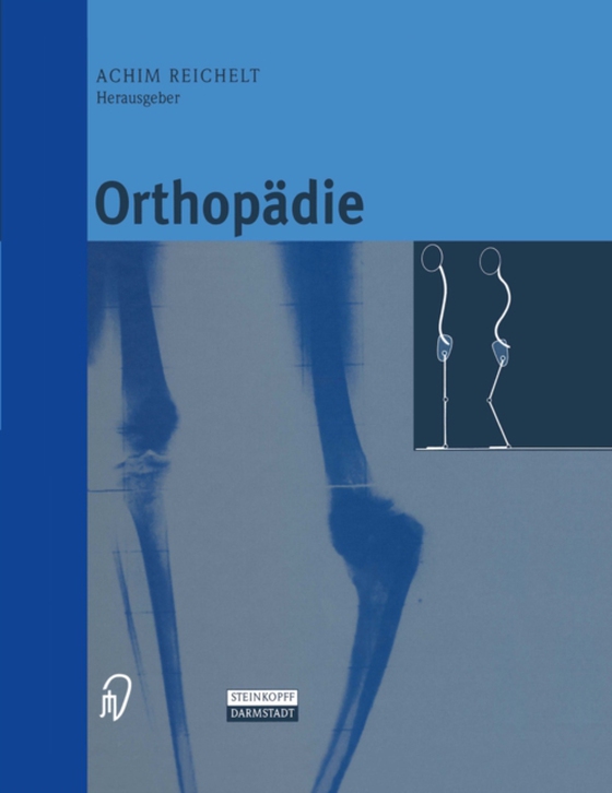 Orthopädie (e-bog) af -