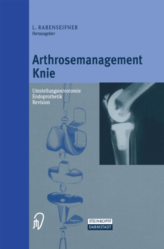 Arthrosemanagement Knie (e-bog) af -