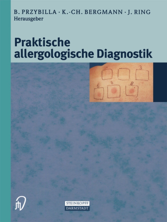 Praktische Allergologische Diagnostik (e-bog) af -