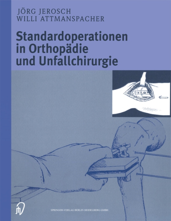 Standardoperationen in Orthopädie und Unfallchirurgie (e-bog) af Attmanspacher, W.