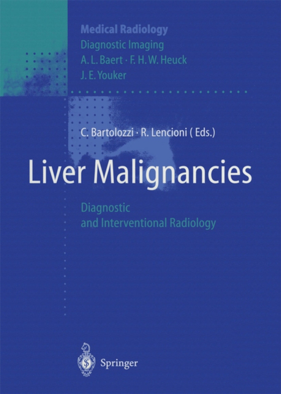 Liver Malignancies (e-bog) af -