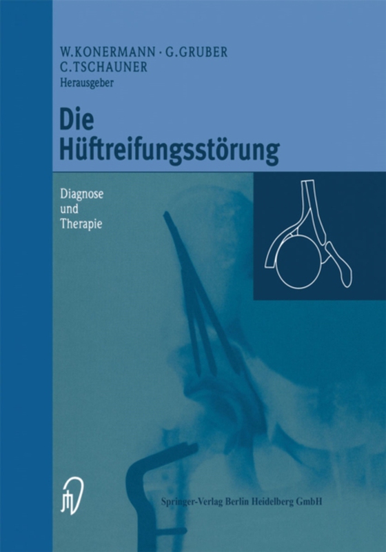 Die Hüftreifungsstörung (e-bog) af -