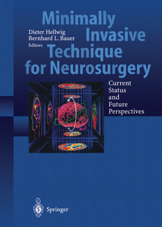 Minimally Invasive Techniques for Neurosurgery (e-bog) af -