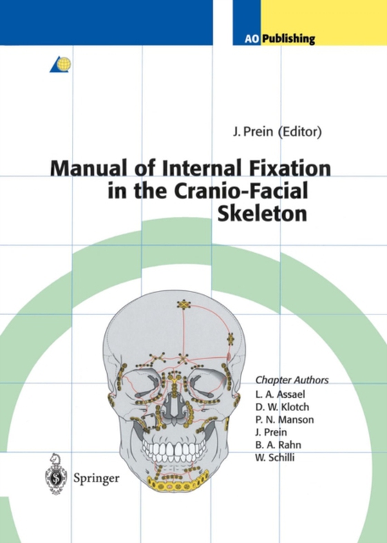 Manual of Internal Fixation in the Cranio-Facial Skeleton (e-bog) af -