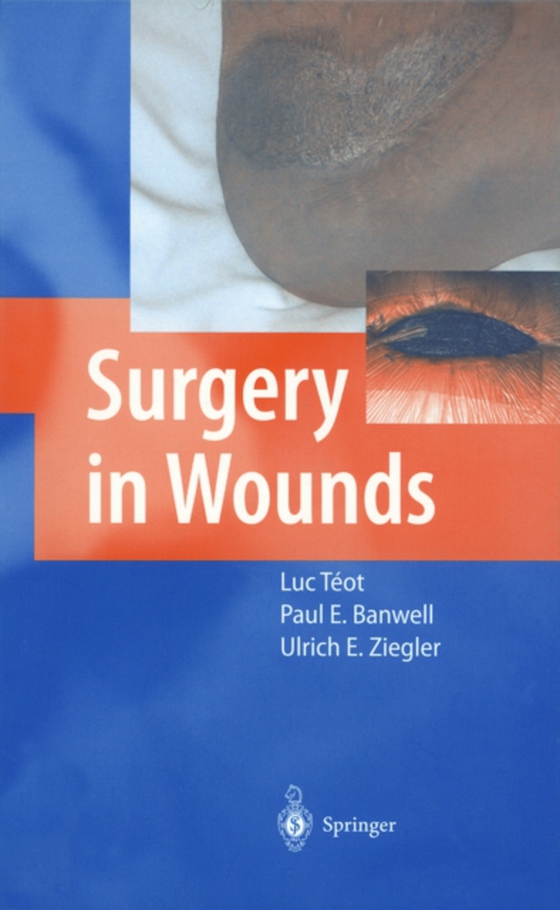 Surgery in Wounds (e-bog) af -